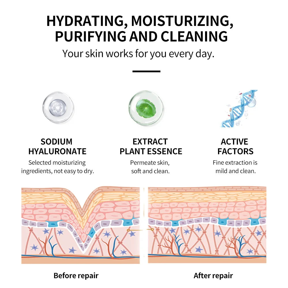 250ml Vitamin C Facial Toner  Kojic Acid Brightening Skin Tone Body Toner with Hydrating and Moisturizing Anti-Wrinkle