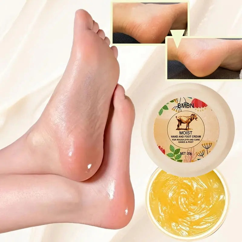 Moist Hand Foot Cream For Rough Dry Skin Deeply Repairs Cracked Skin Moisturizes Ingredient Lanolin Protective Stick Hand Cream