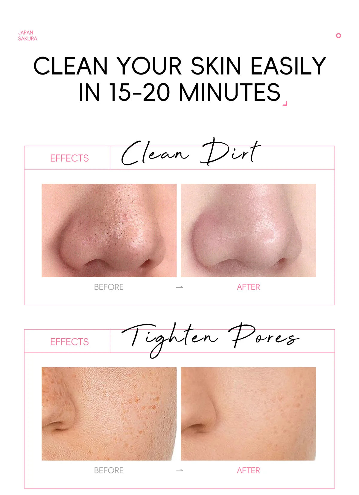 LAIKOU Cherry Blossom Peel Off Mask ,Hydrating & Deep Cleansing Brightening Face Mask for Blackhead Removal and Pore Minimizing