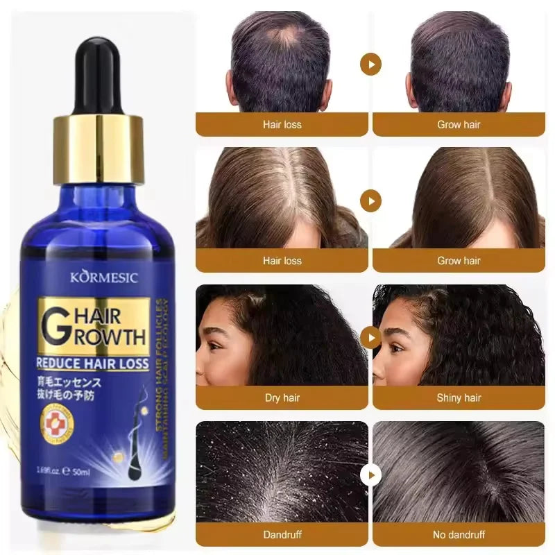 Hair Growth Serum Anti Loss Regrowth Hair Growth Oil Prevent Baldness Repair Damage Scalp Massage Moisturizing Nourish Hair Care