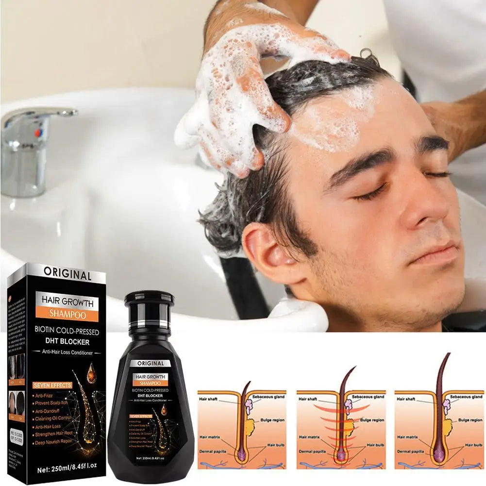 1/2/3Pcs Hair Growth Shampoo, Ginger Shampoo Deep Cleaning Nourish Scalp Deep Cleaning Nourish Scalp Enhance Hair Elasticity