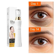Anti Dark Circle Eye Serum Oil Retinol Anti Wrinkle Firming Skin Remove Eye Bag Fade Fine Line Whitening Brighten Eye Care Korea
