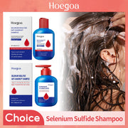 Selenium Sulfide Shampoo Deep Cleansing Remove Dandruff Reduce Scalp Itchy Balance Oil Strengthen Hair Roots Fluffy Hair Shampoo