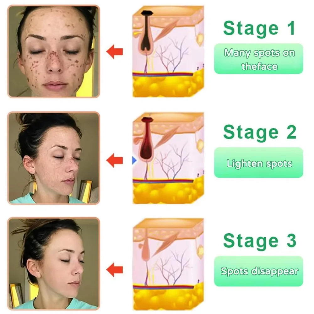 Revitalize Skin Fruit Acid Peeling Gel Facial Cleansing Exfoliating Peeling Scrub Deep Clean Acne Blackhead Remove Face Cleanser