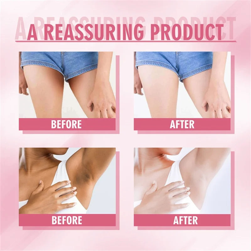Niacinamide Body Whitening Cream For Underarm Bleaching Armpit Lightening Intimate Area  Moisturizer Korean Skin Care Product