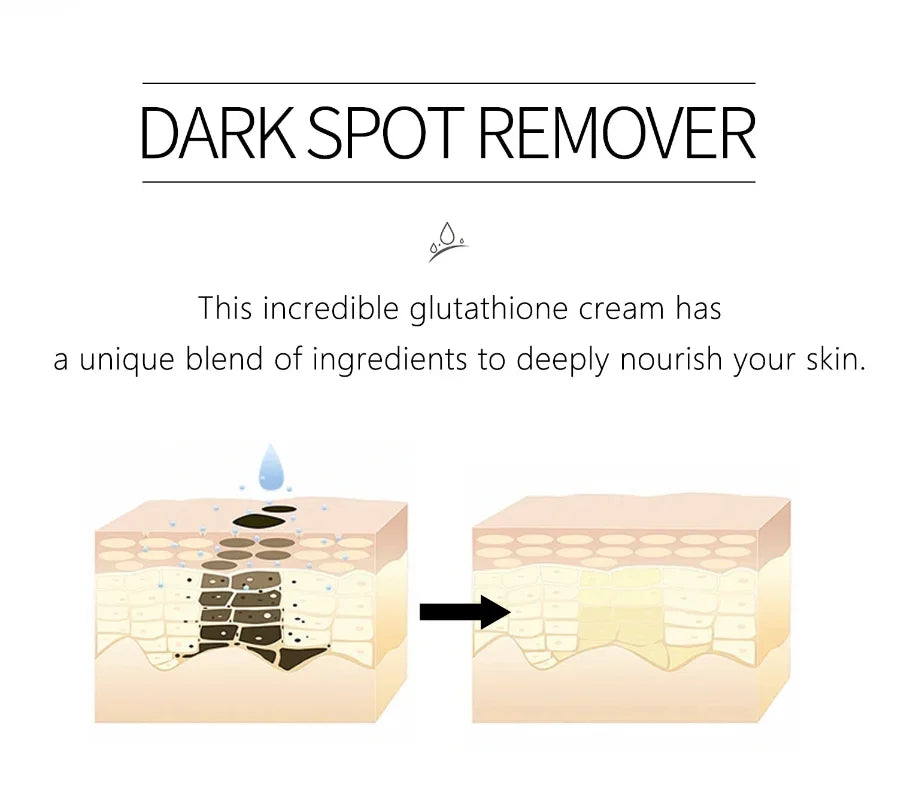 Vitamin C Brightening Freckles Cream Nicotinamide Improve Dark Spot Melanin Moisturizing Nourishing Facial Serum Skin Care
