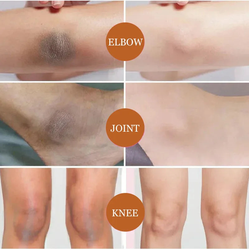Whitening Cream For Dark Skin Underarm Bleaching Armpit Lightening And Intimate Area Woman Moisturizer Korean Skin Care Products