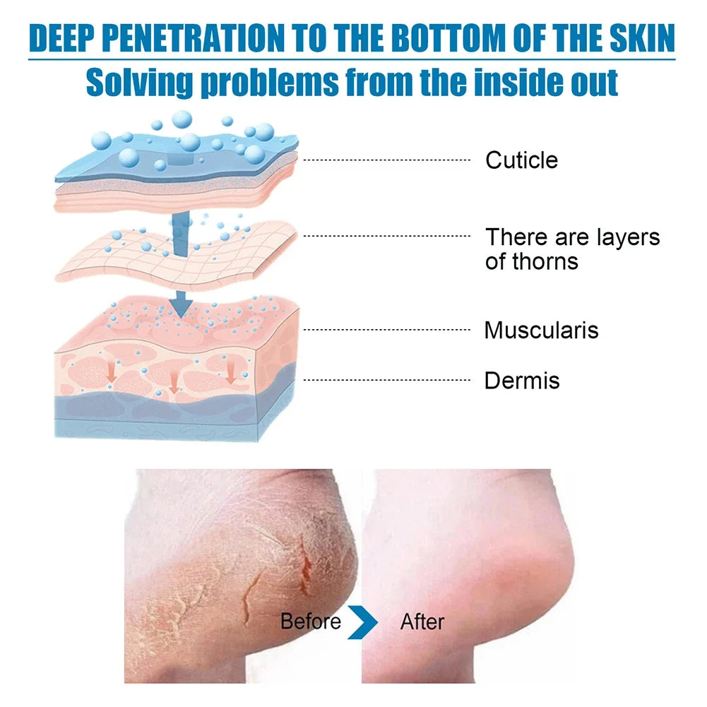 1-10 Pairs Exfoliating Callus Booties Feet Care Foot Mask Sheet Pack Nourish Smooth Moisturizing Foot Spa Skin Care for Feet