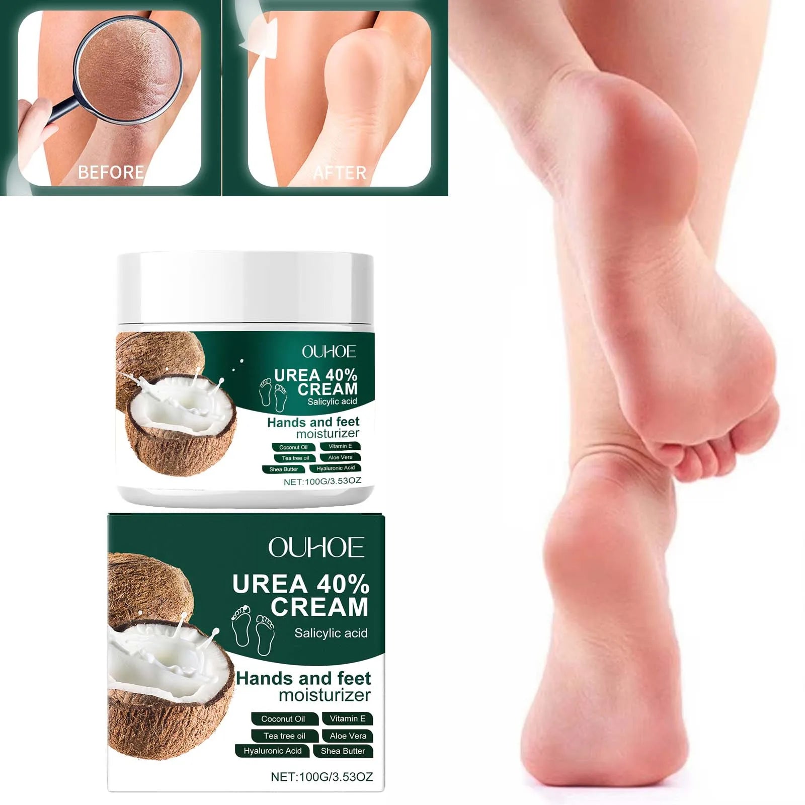 Urea 40% Cream Salicylic Acid Hand Foot Cream for Cracked Heels & Dry Skin Moisturizing Hydrating Callus Remover Smooth Skin