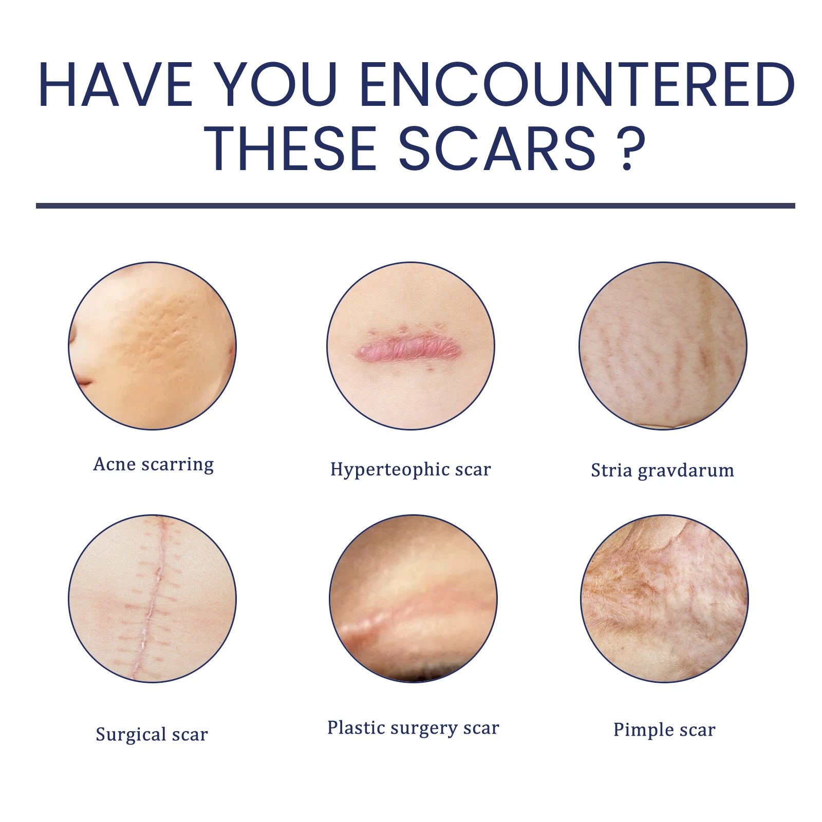 EELHOE Silicone Skin Scar Gel Retinol Niacinamide Scars Stretch Marks Burn Marks Deeply Nourish Skin Reduce Redness Swelling 30g