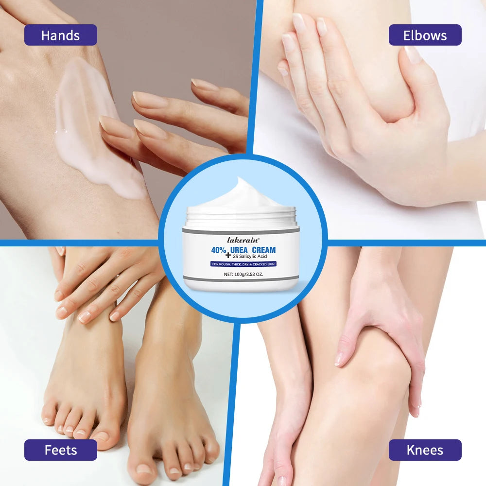 New 42% Urea Cream + 2% Salicylic acid Foot and hand Moisturizer, deep moisturizer and Nourishing moisturizer