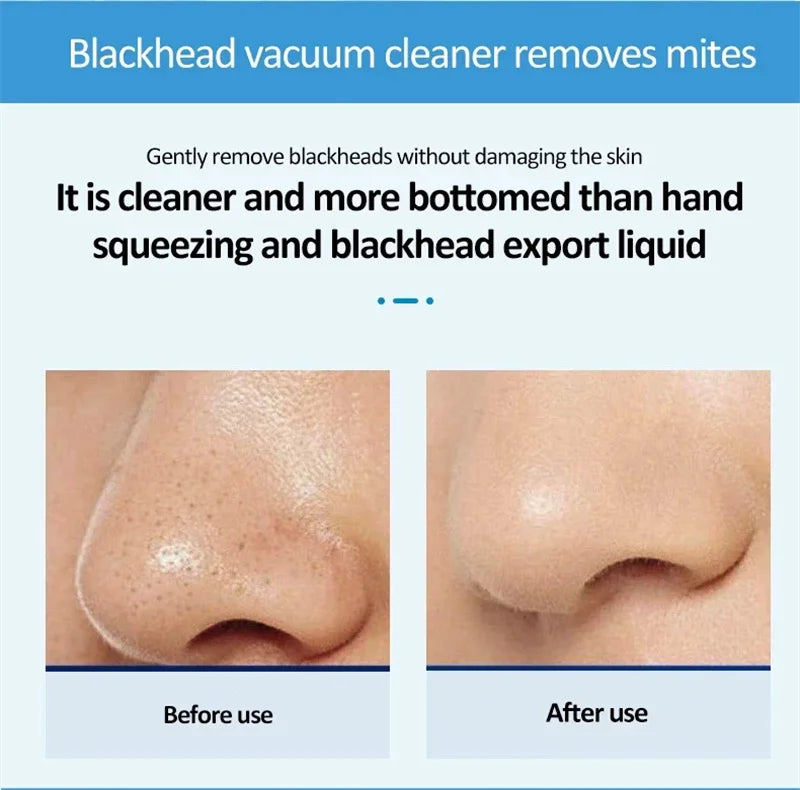 Blackhead Remover Liquid 400ml Deep Cleansing Pore Minimizer with Fruit Acid, Oil Control Toner for T-Zone & Blackhead Treatment