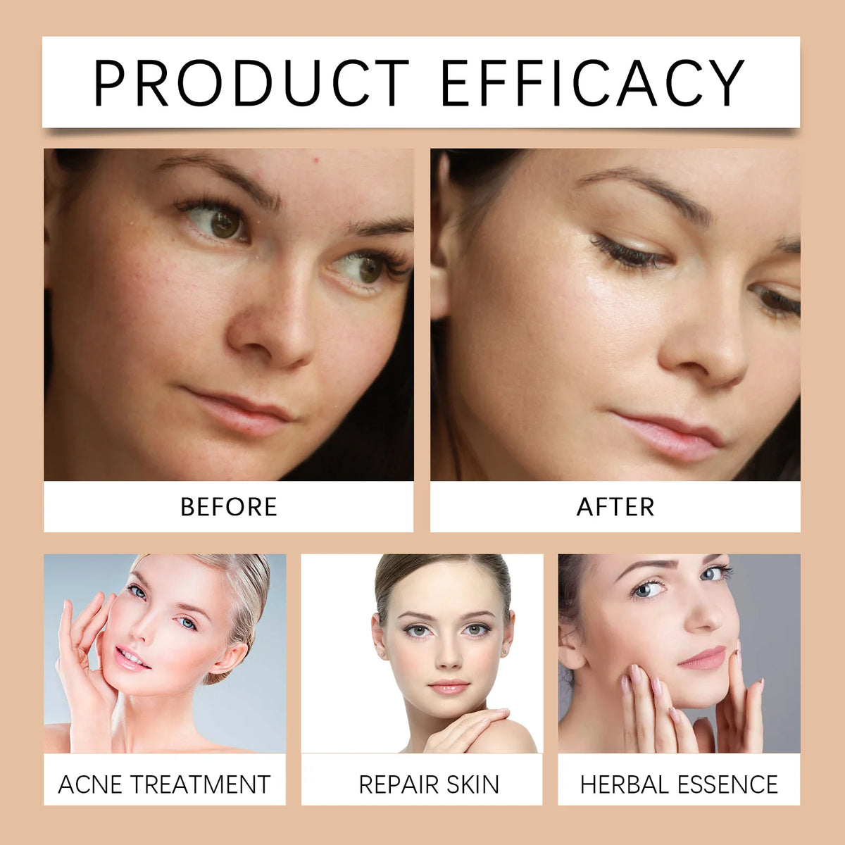 Salicylic Acid Pore Toning Lotion for Oily Clear Skin Exfoliates Gently Unclogs Pores Hydrates Without Drying 100ml Non Drying