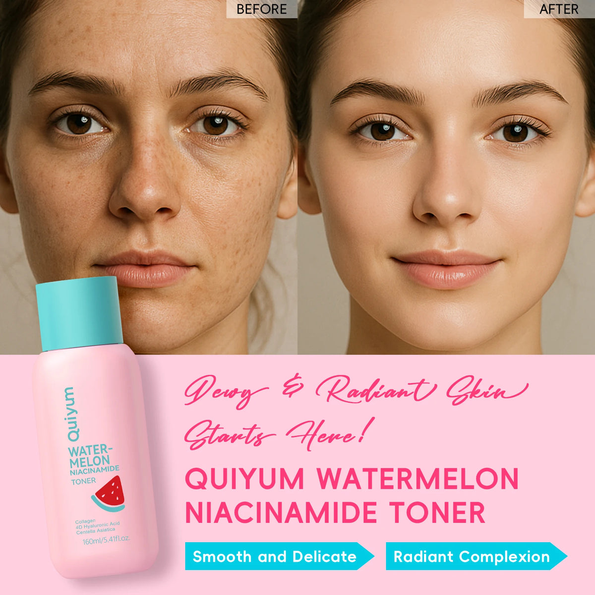 Quiyum Watermelon Niacinamide Toner 160ml Deep Hydration Reveal Radiance with 4D Hyaluronic Acid