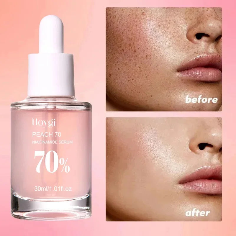Moisturising Anti-Drying Facial Oil Increase Elasticity Smooth Softening Skin Care Peach 70% Niacinamide Serum 30ml