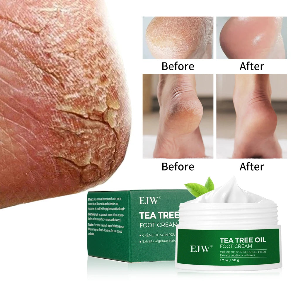Tea Tree Oil Foot Cream, Warming Cream - Calluses, Dry Cracked Feet, Hands, Heels, Elbow -Softens & Moisturizes Skin, Foot Balm