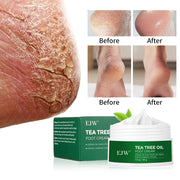 Tea Tree Oil Foot Cream, Warming Cream - Calluses, Dry Cracked Feet, Hands, Heels, Elbow -Softens & Moisturizes Skin, Foot Balm