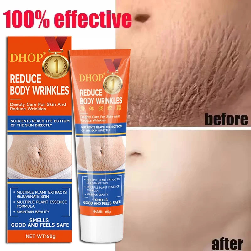 Stretch Marks Permanent Removal Cream Maternity Pregnant Women Pregnancy Anti-Winkle Smooth Repair Firming Skin Body Skin Care