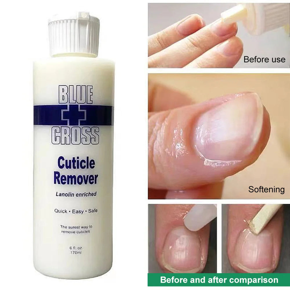 30/177/473Ml Nail Cuticle Removal Gel Cream Foot Cuticle Remove Soften Dead Skin Foot Exfoliation Softener