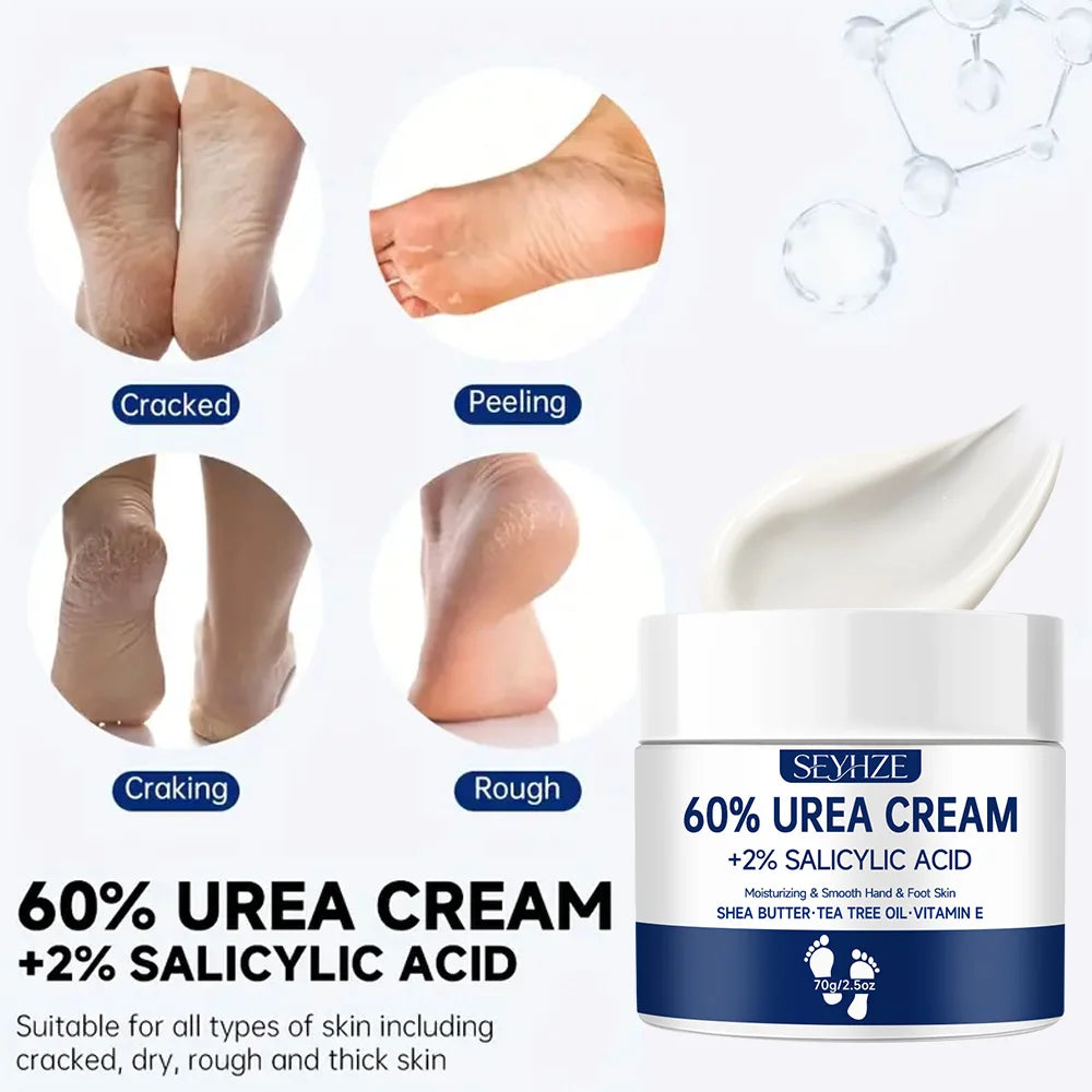 SEYHZE 60% Urea Foot Cream with 2% Salicylic Acid, moisturizing cream suitable for cracked heels and dry hands, soft light beige